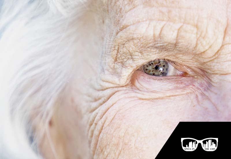 Specs in the City - Blog - Am I At Risk For Age-Related Macular Degeneration